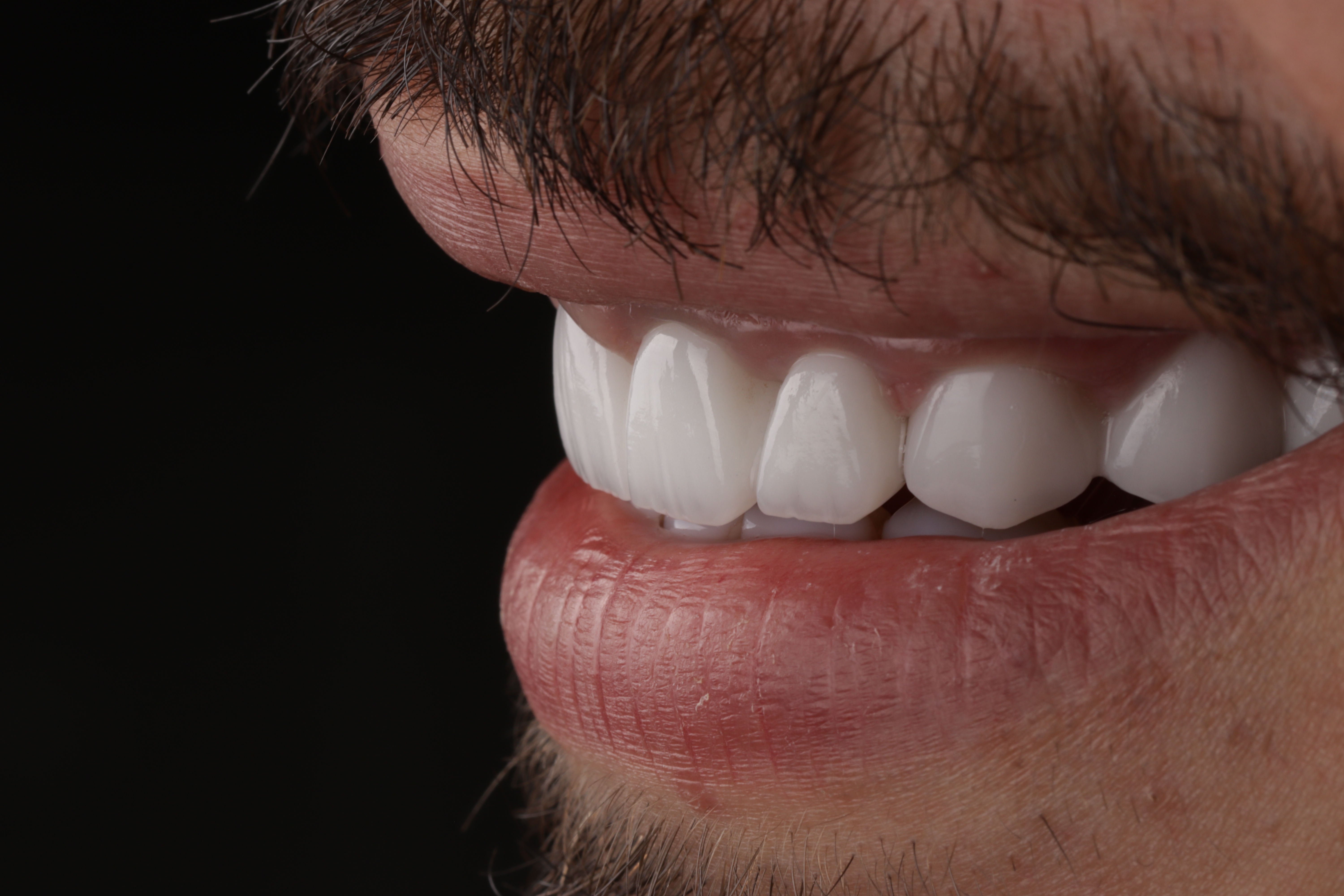 AuraDent Clinic smile result